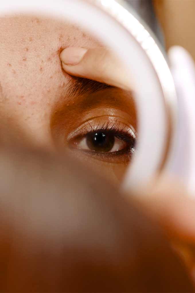 Best products for adult acne and wrinkles