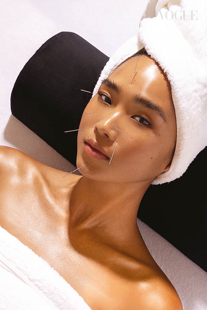Best wellness rituals such as facial acupuncture to incorporate into your beauty regime