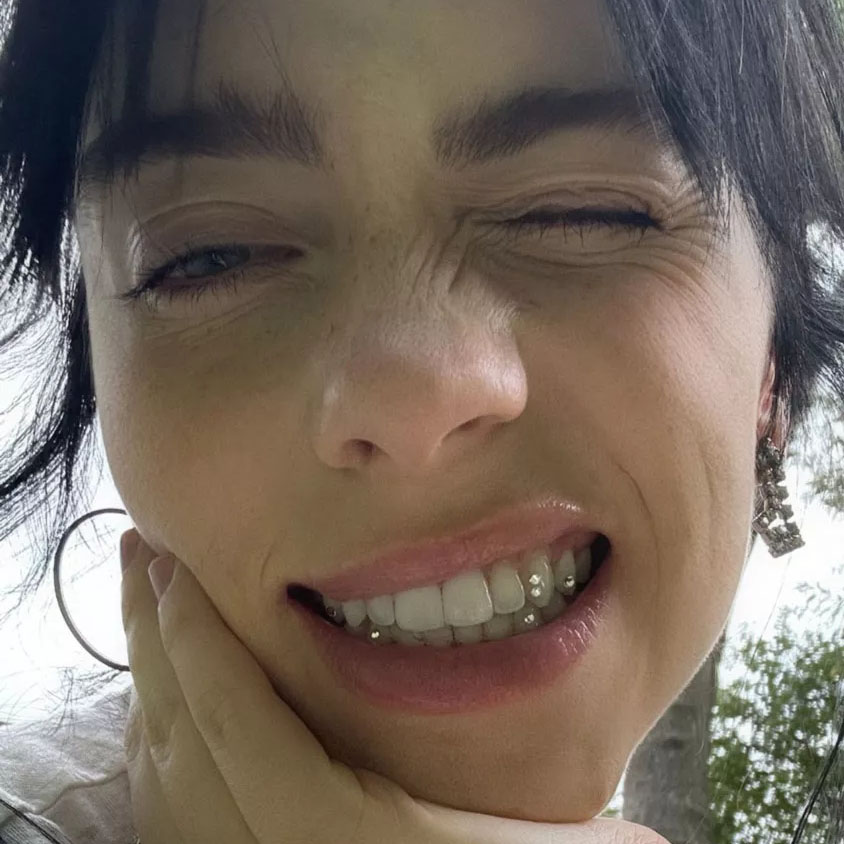 Your favourite celebs might be getting tooth gems but should you?