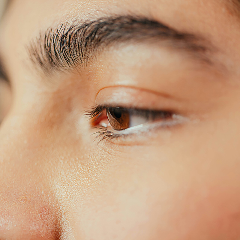aesthetic treatment around eyes