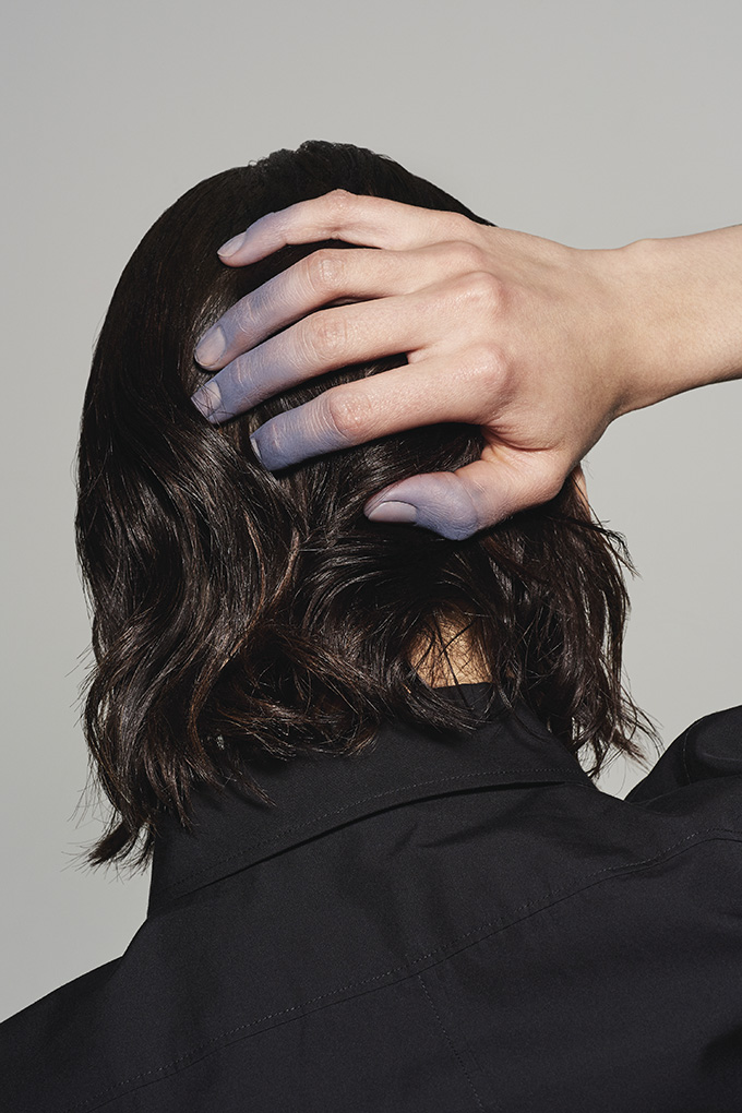 male hair loss